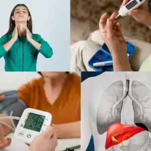 Lifestyle Disorders